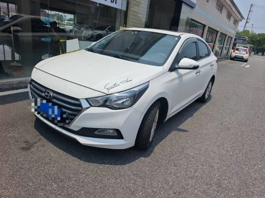 Yue Na 2016 Model Year 1.4L Automatic Elite Edition TOP